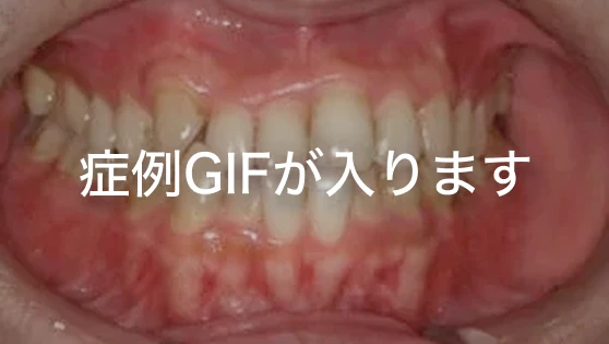 症例写真